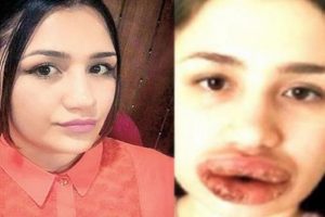 Genç kızı bu hale getirmişti