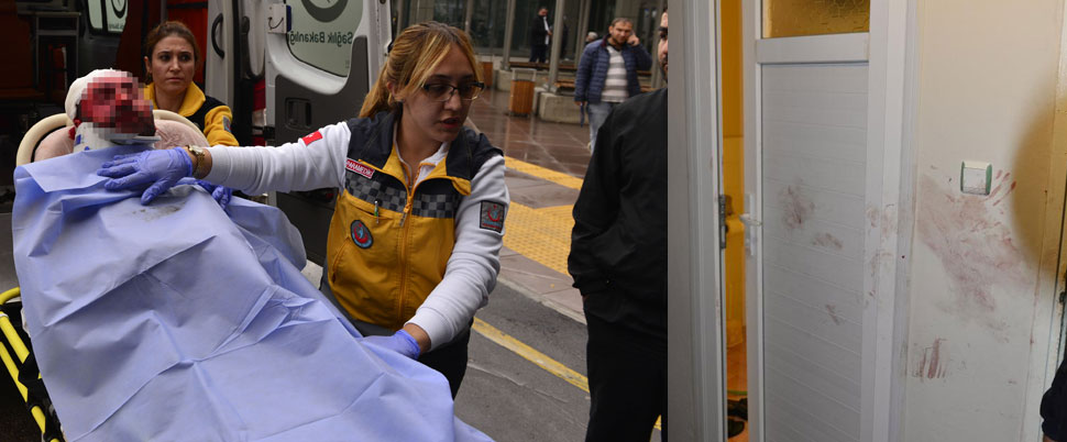 Boşandığı eşinin üstüne kızgın yağ döktü!