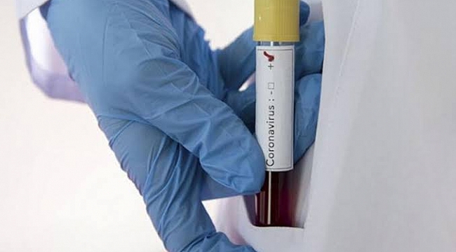Roche Covid-19 ilaç testlerine başlıyor