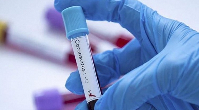 Corona virüs test ücreti belli oldu