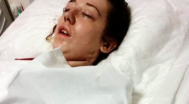 İrem, 9 gündür yaşam mücadelesi veriyor
