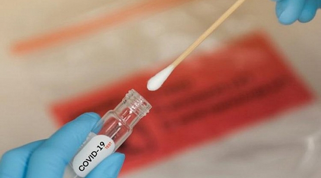 30'dan fazla ülkede günlük vaka sayısı bini geçti!
