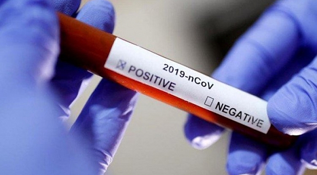 ABD'de hızlı Kovid-19 antijen testi üretilecek
