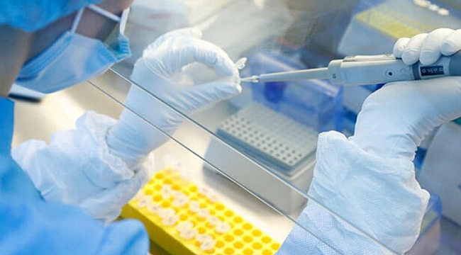 Dünyada can kaybı 1 milyon 6 bin 458'e ulaştı