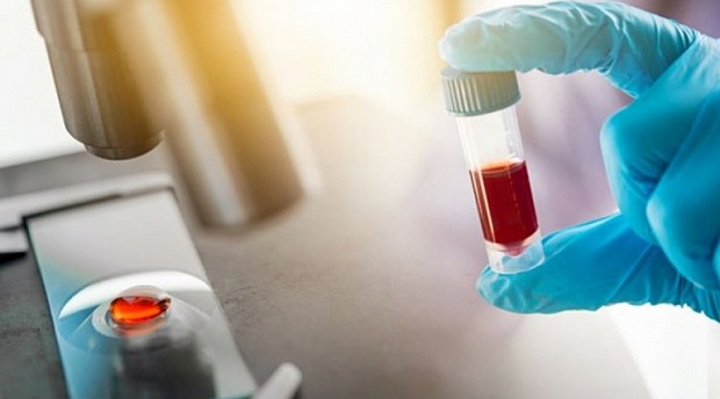Corona virüse karşı antikor üretimi en az 3 ay sürüyor
