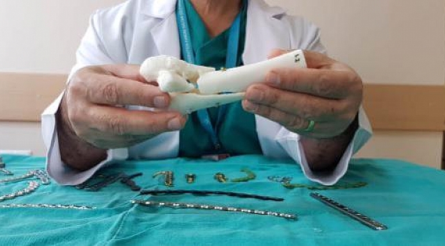 Ameliyat provası ile kişiye özel kırık tedavisi
