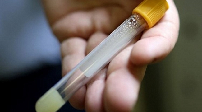 Kan örneğinden corona virüs testi