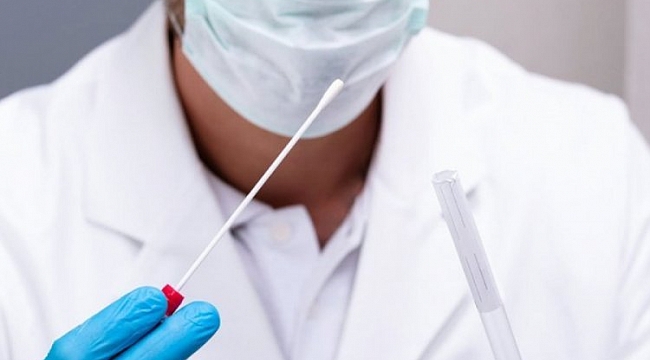 Covid 19 test sonucu öğrenme nasıl yapılır?