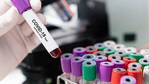 Dünyada can kaybı 2 milyon 140 bin 88'e yükseldi