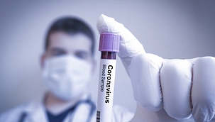 Dünyada iyileşenlerin sayısı 69 milyonu geçti