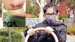 İki santimle hayata tutundu! 