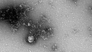 Koronavirüs mutasyonunun fotoğrafı çekildi 