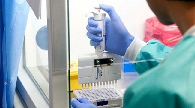 Koronavirüs testlerinde bile dolandırıcılık yapmışlar!