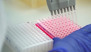 Almanya'da korona virüsten 481 ölüm 