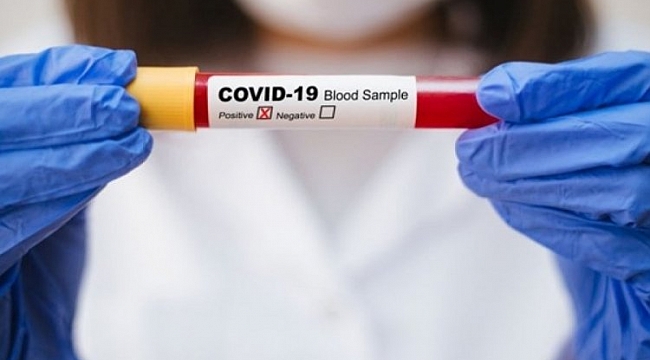 Covid geçirenler tekrar enfekte olabilir