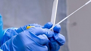 Kovid-19'u 5 dakikada saptayabilen test metodu bulundu 