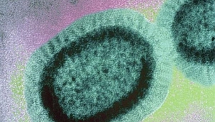 Oxford Profesörü koronavirüs ile mücadeleyi satranca benzetti 