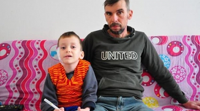 6 yaşındaki Kazım'ın derisi, protezi kabul etmedi