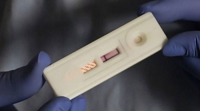 Bilim Kurulu üyesi 'HIV' ile ilgili uyardı