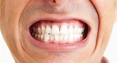 Diş sıkma problemini önemseyin!