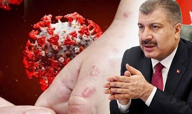 Eris varyantı Türkiye'de