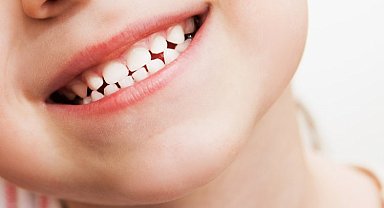 Çocuklarda diş çürüğü neden olur? Nelere dikkat edilmeli?