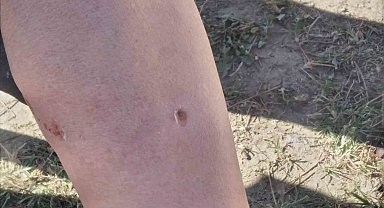 Germencik'te yaşlı adama köpekler saldırdı