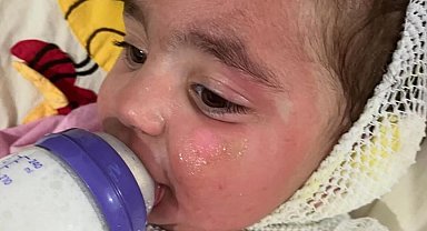 Kreşte çocuğun üzerine kahve döküldü