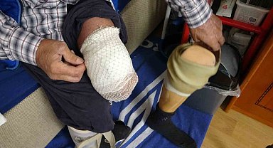 Bir zamanlar mahallenin neşesiydi şimdi evden dışarı çıkamıyor
