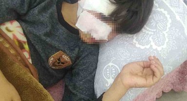 Gaziantep'te 8 yaşındaki çocuğa 5 sokak köpeği saldırdı