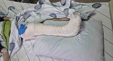 Diyarbakır'da köpeklerden kaçan çocuğun bacağı kırıldı