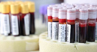 Kızılay'a 2024'te 2 milyon 800 bin ünite kan bağışlandı