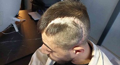 Patronunun öldüresiyle darp ettiği çalışan yüzde 32 fiziksel engelli kaldı