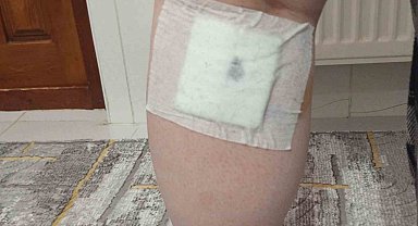 Sokak köpekleri anne ve oğluna saldırdı