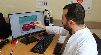 300 gramlık prostat dokusu başarıyla çıkarıldı