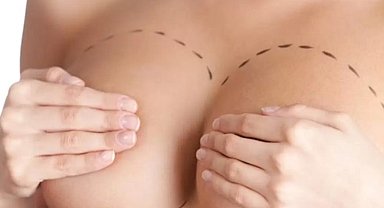 Büyük göğüsler, büyük sorunlar... Ameliyata kimler uygun aday?