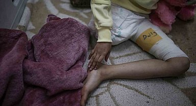 İsrail'in patlayıcı silahları 2024'te her gün 15 çocuğu engelli bıraktı