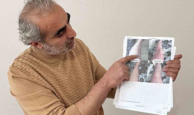 Jeoloji mühendisi sedef, egzama, uyuz ve vitiligo için krem üretti