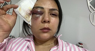 Yürürken saldırıya uğrayan genç kız konuştu: "Psikolojim altüst oldu"