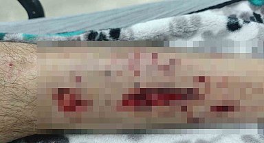 Evinin yolunu karıştıran Alzheimer hastası adam köpeklerin saldırısına uğradı