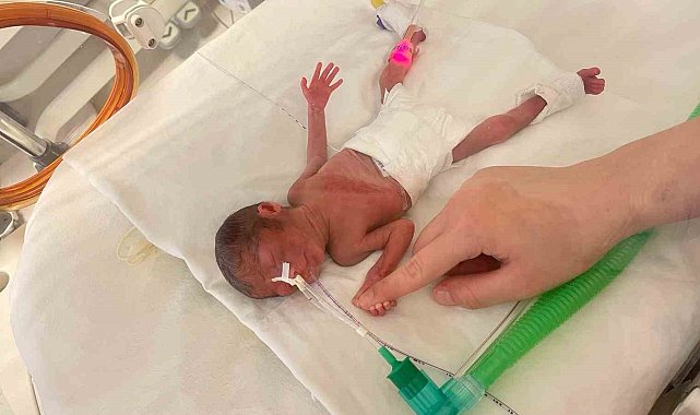 400 gram doğan Aylin bebek hayata tutundu