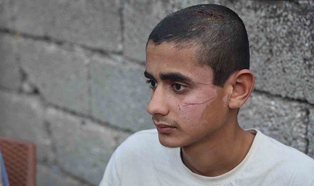 Altı kişinin öldüğü kazada yaralı kurtulan 17 yaşındaki çocuk, "Kazayı hatırlamak istemiyorum, kötü oluyorum"