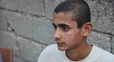 Altı kişinin öldüğü kazada yaralı kurtulan 17 yaşındaki çocuk, "Kazayı hatırlamak istemiyorum, kötü oluyorum"