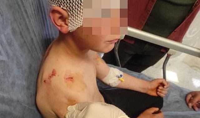 Isparta'da sokakta oynayan çocuğa başıboş köpek saldırdı
