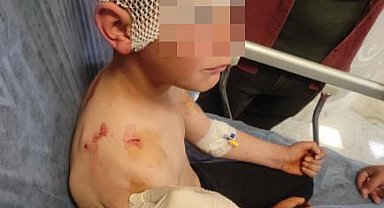 Isparta'da sokakta oynayan çocuğa başıboş köpek saldırdı