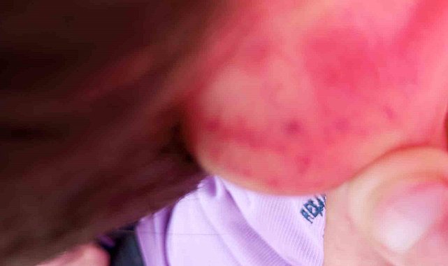 Otizmli çocuğunu darp ettiği iddia edilen babaya hapis cezası