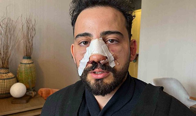 Siparişler geciktiği için gitmek isteyen müşteriye restoran çalışanlarından öldüresiye darp