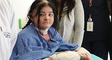Amerikalı Ledesa'nın parmakları evinden 9 bin 930 kilometre ötedeki Eskişehir'de açıldı