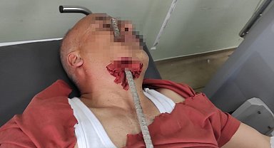 İnşaat işçisinin yüzüne demir saplandı