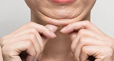 Keşanlı 3 dermatolog, Tiflis'teki Dermavizyon toplantısında buluştu